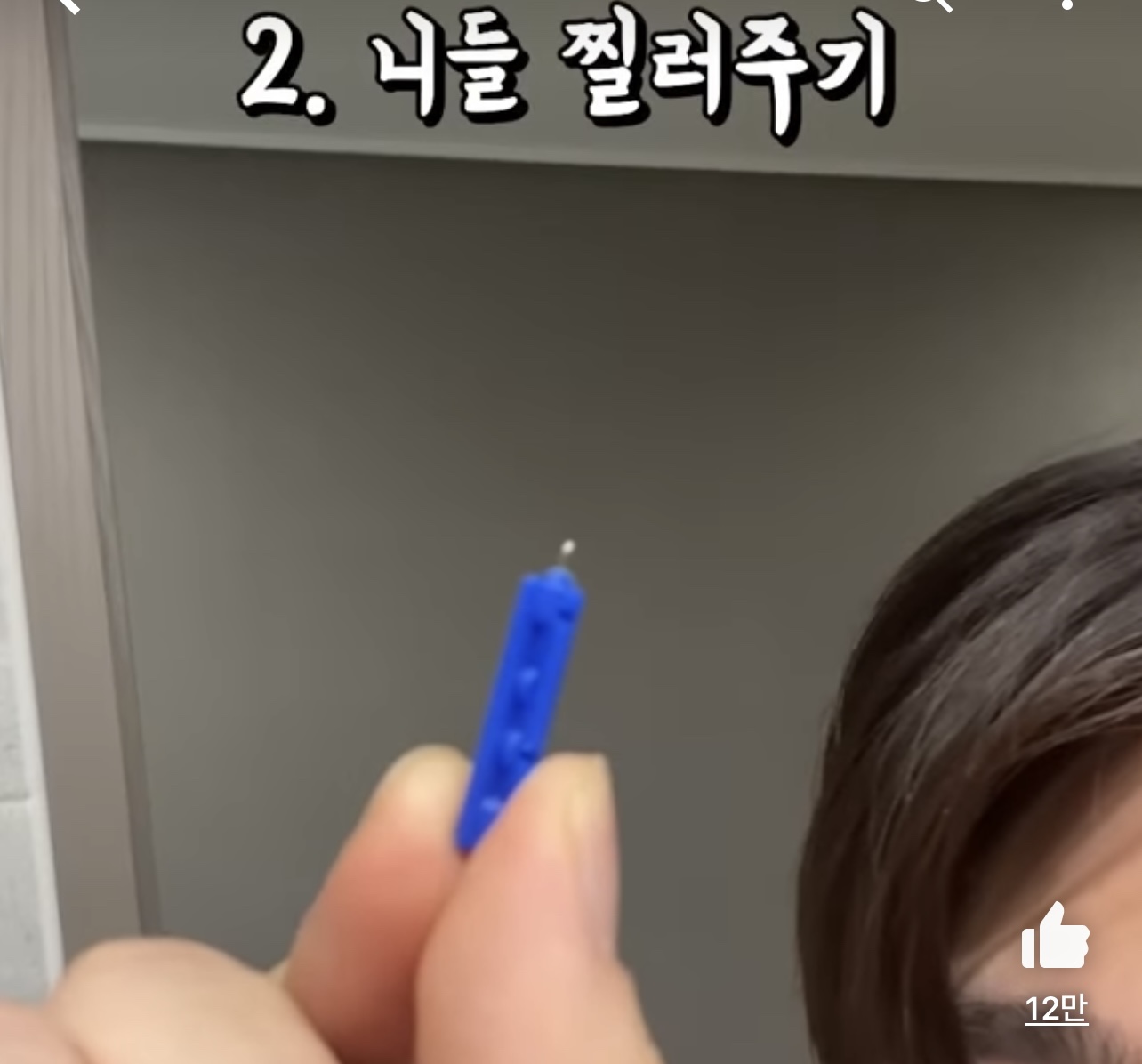 흉터 없이 여드름 짜는 방법