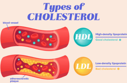 중성지방 낮추는 방법, 중성지방 정상수치