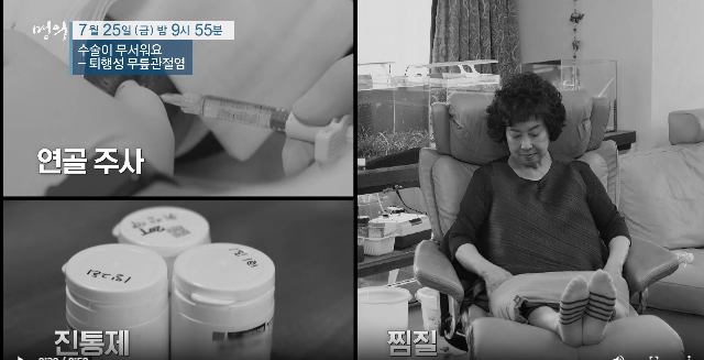 명의 퇴행성 무릎 관절염