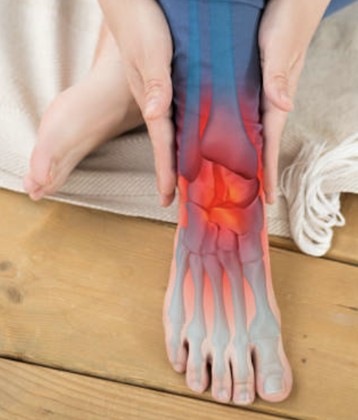 발바닥통증의 원인 32