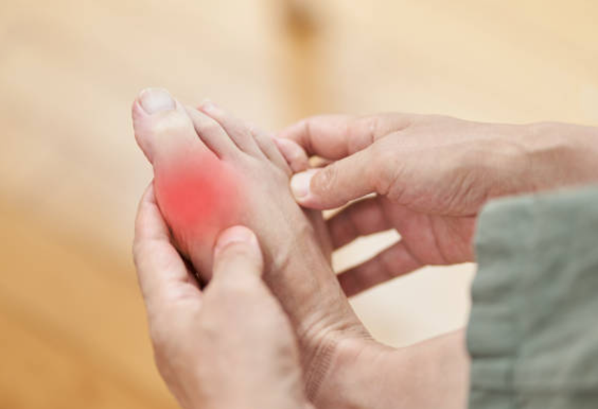 통풍과 관련된 사진