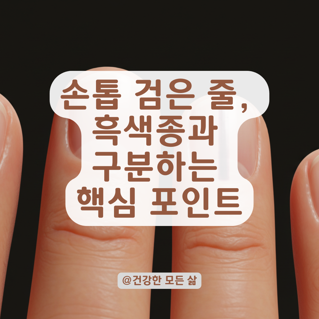 손톱 검은 줄, 단순 색소 침착일까? 흑색종과 구분해야 할 핵심 특징 정리.