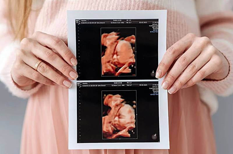 임신-초기-태아의-사진을-들고있는-모습