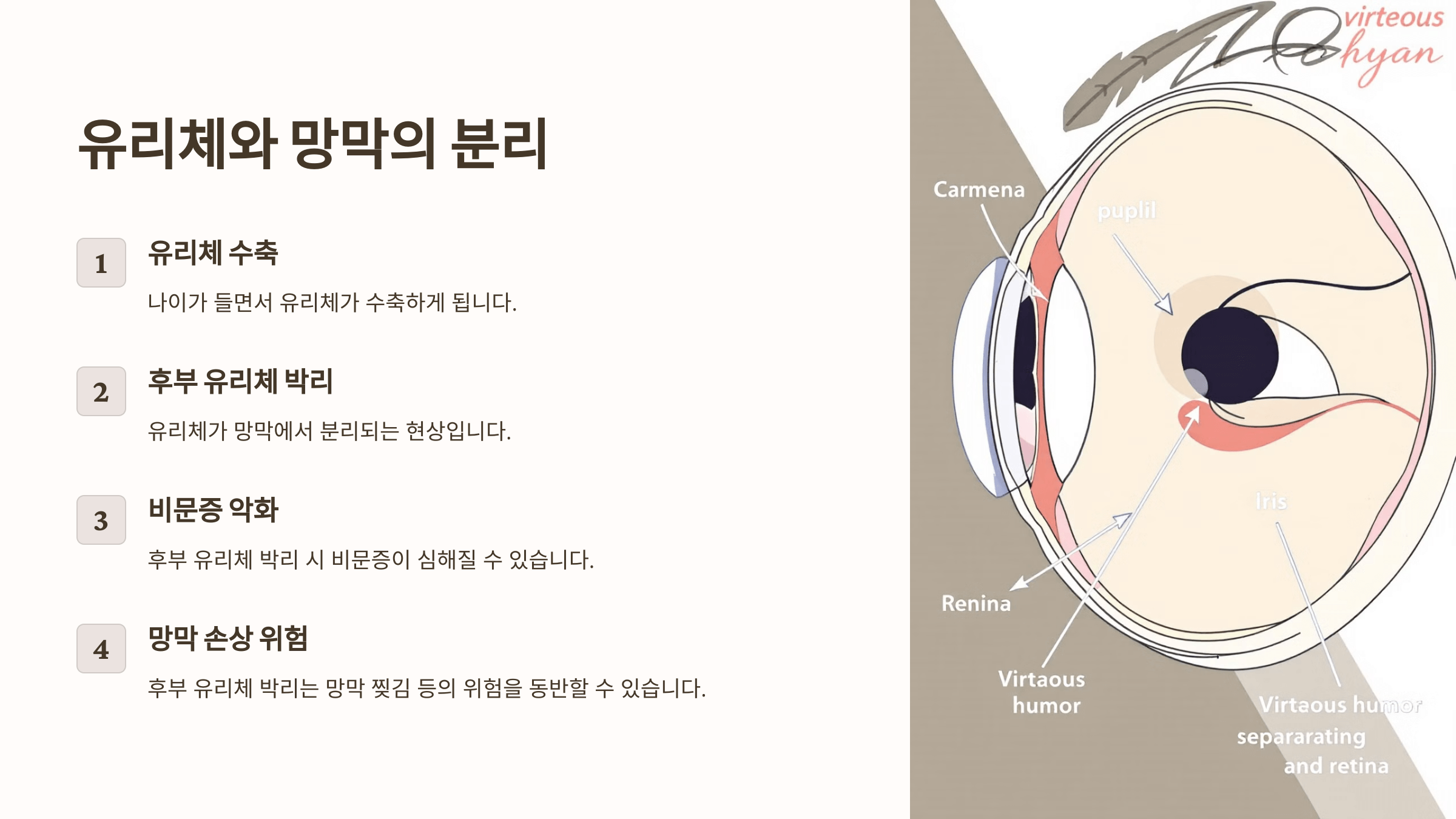 비문증과 관련된 사진입니다.