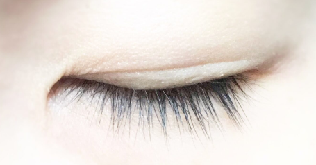 가벼운 안검하수