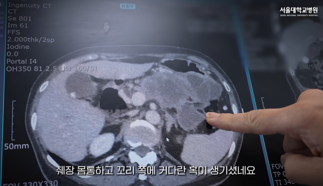 췌장암-명의