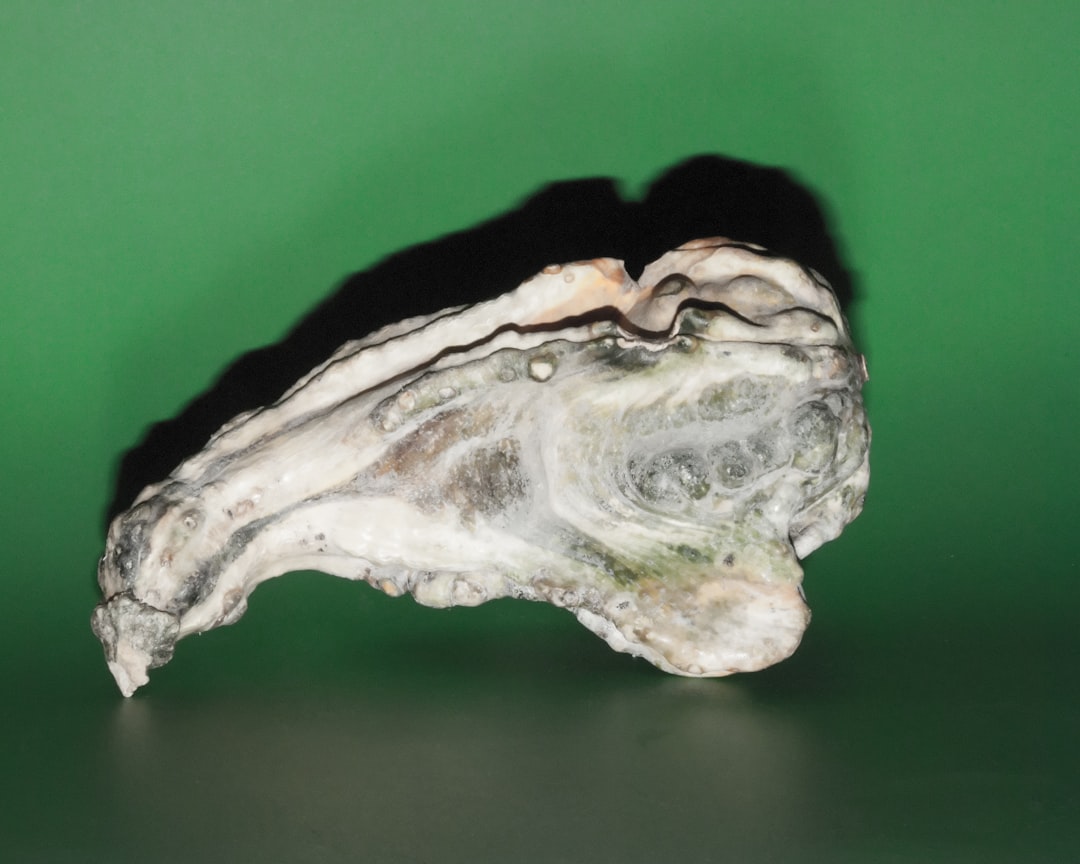 Acromegaly