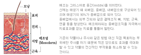 메조테라피