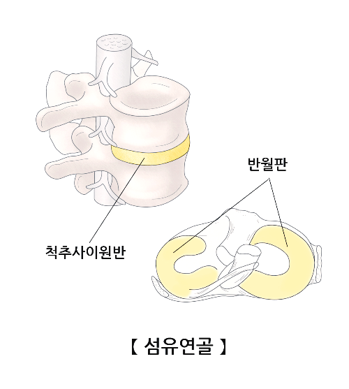 콘드로이친 효능 부작용