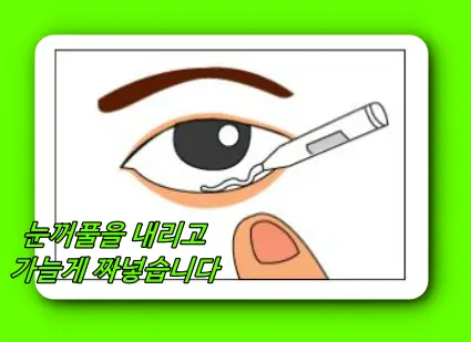 안연고 바르는법