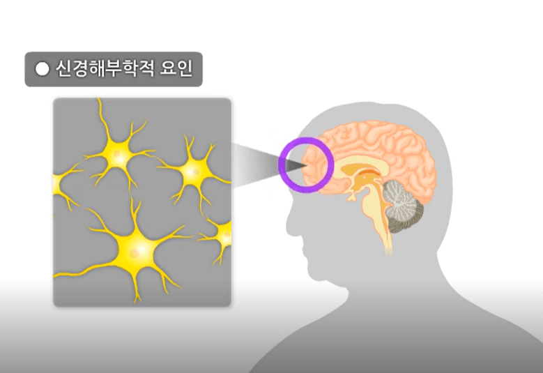 우울증의 생물학적 요인5