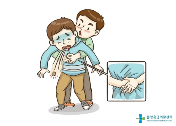소아 성인 하임리히