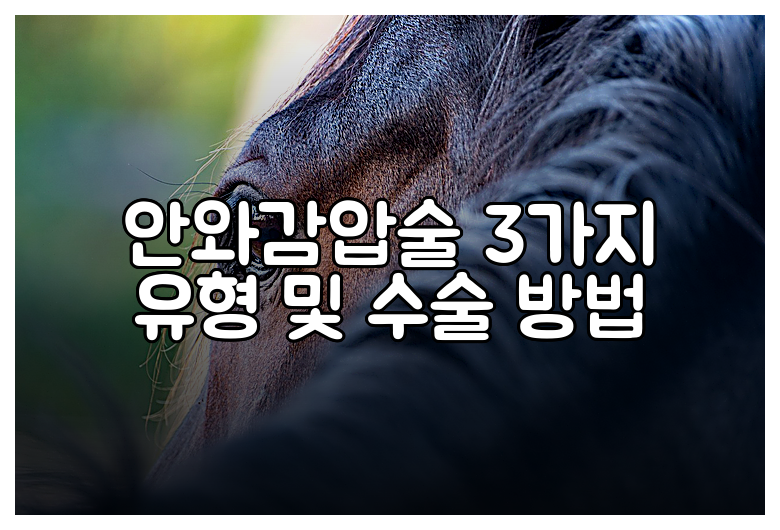 안와감압술 3가지 유형 및 수술 방법