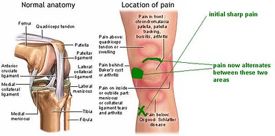 무릎_통증_원인