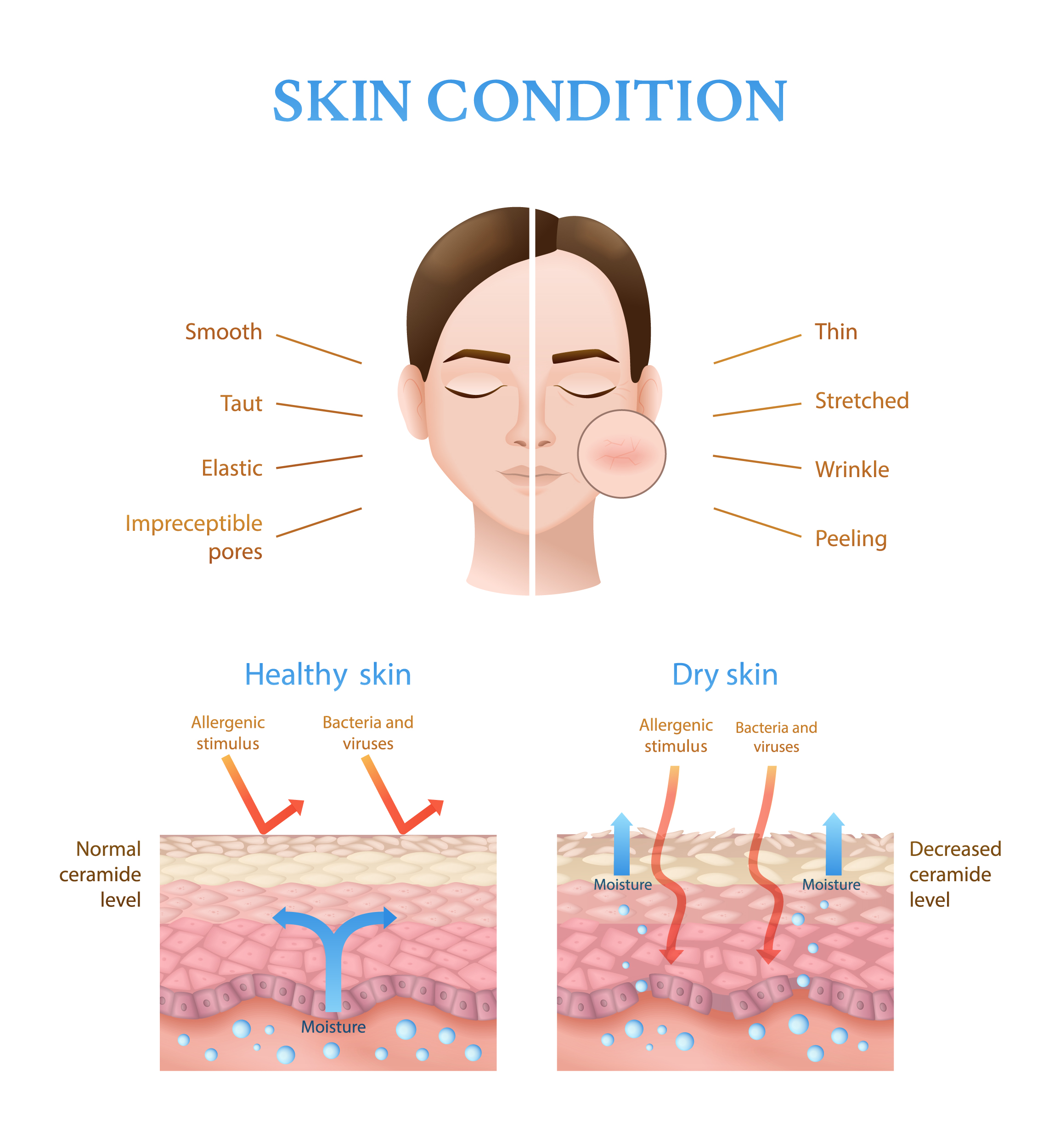 정상 피부와 건조 피부의 구조적 차이를 비교해 장벽 약화와 수분 감소 변화를 보여주는 일러스트