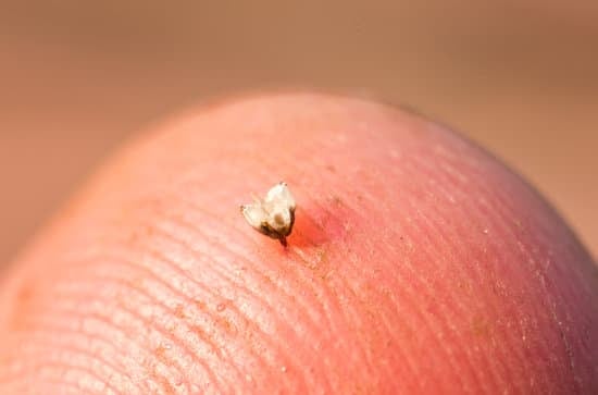 벌에 쏘였을때 대처방법