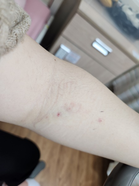 항생제-반응-검사