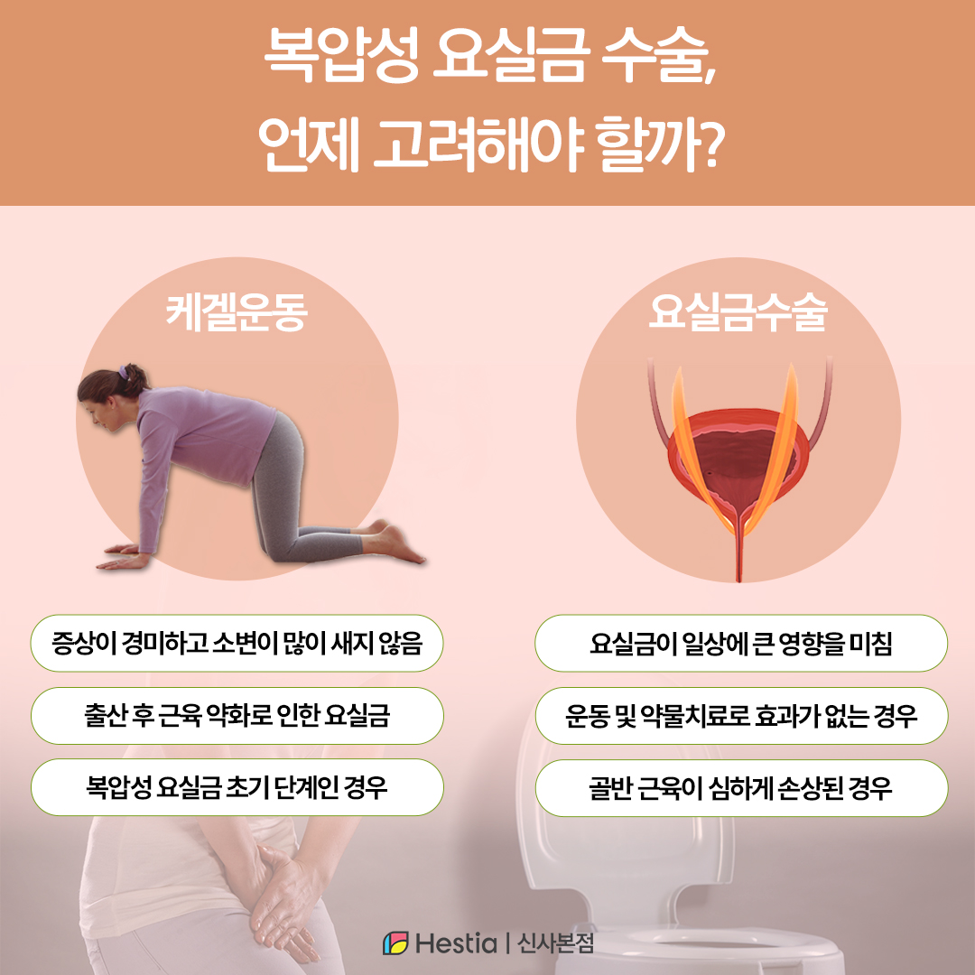 복압성 요실금 수술, 언제 고려해야 할까?