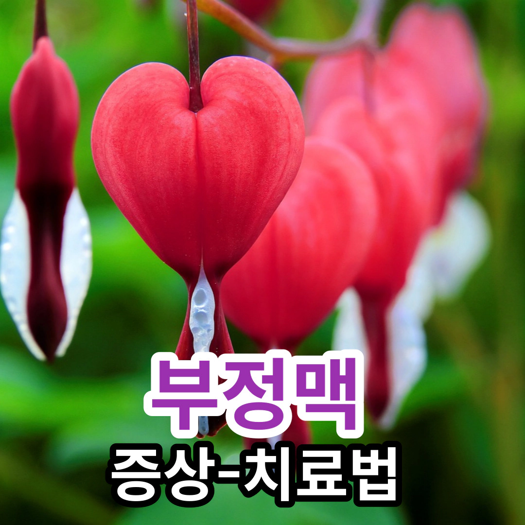 [부정맥] 증상-치료법(시술)