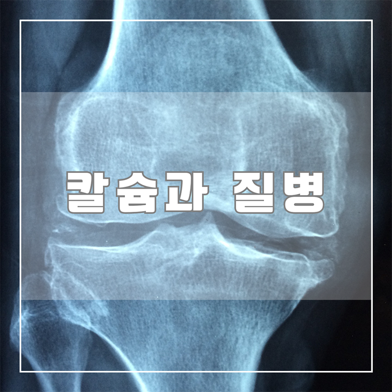 칼슘과 질병