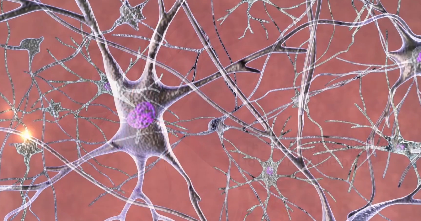 뇌경색 전조증상