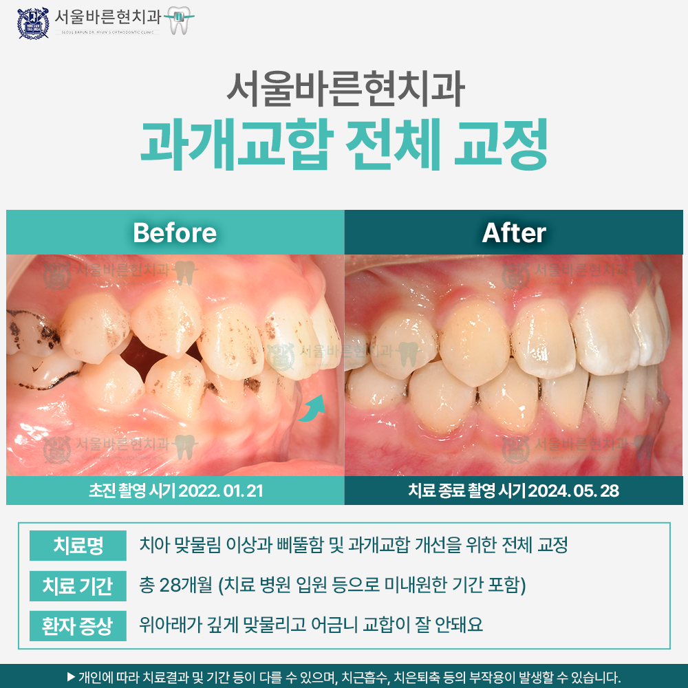 해운대교정치과