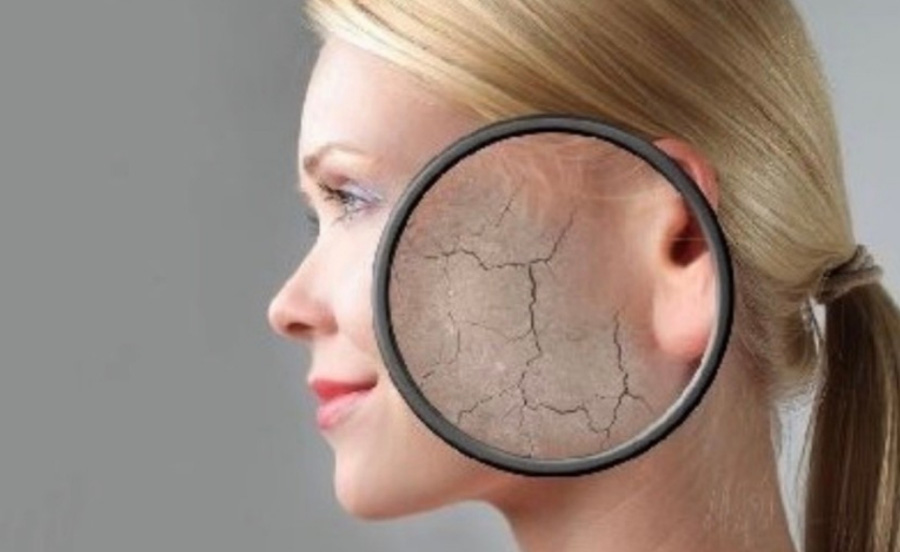 서양의 젊은 여성의 옆에 볼을 돋보기로 확대를 하여 봤을 때, 피부가 건조하여 갈라져 있는 것을 이미지화 한 사진