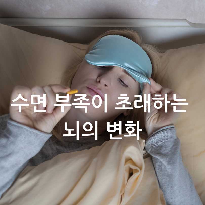 멜라토닌과 치매의 연관성