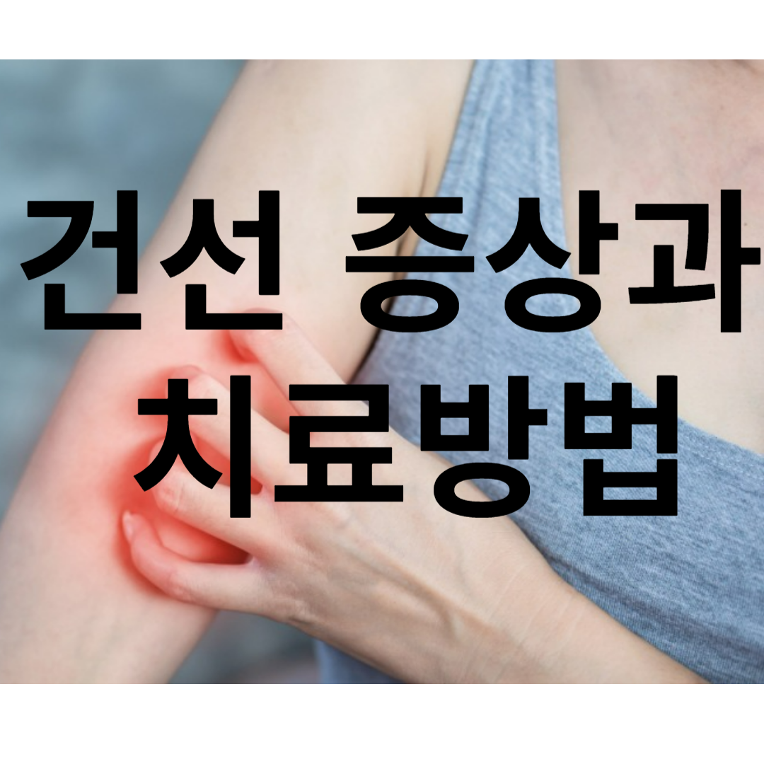 건선 증상과 자가치료