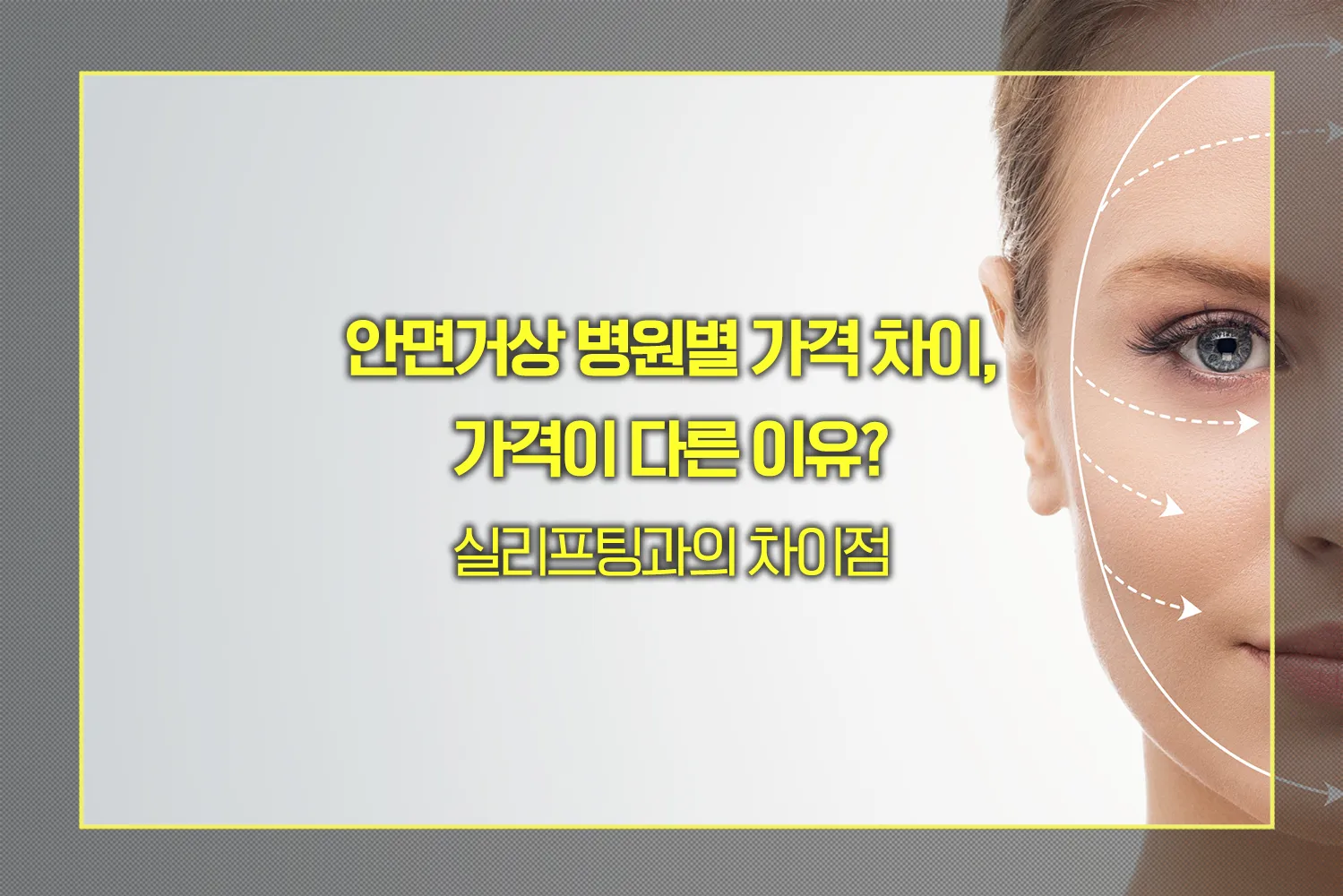 안면거상 병원별 가격 차이