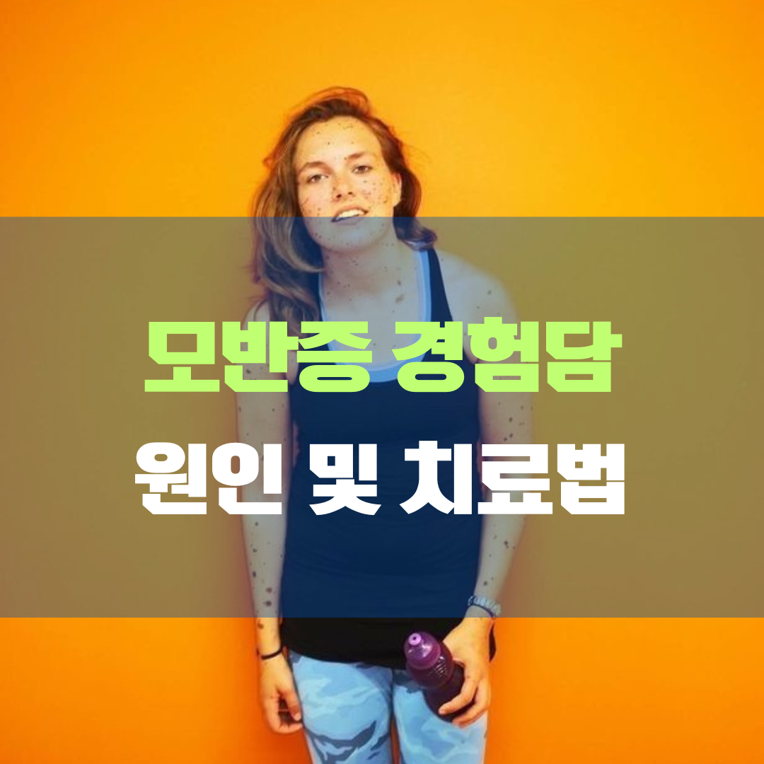 모반증 원인 및 치료와 예방, 경험으로 살펴본 피부를 지키는 방법