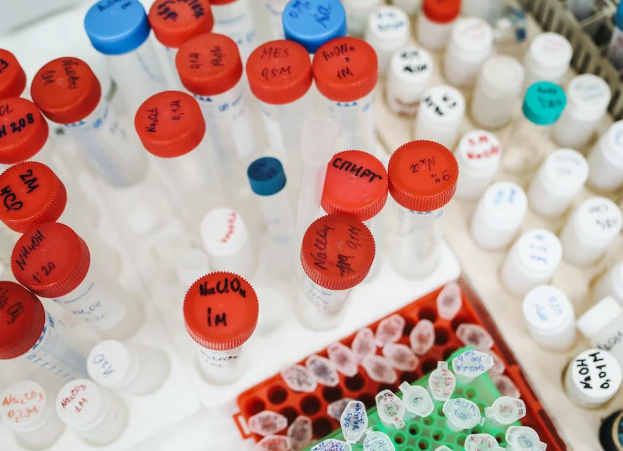 마이크로바이옴 관련주 대장주 4대장 정리