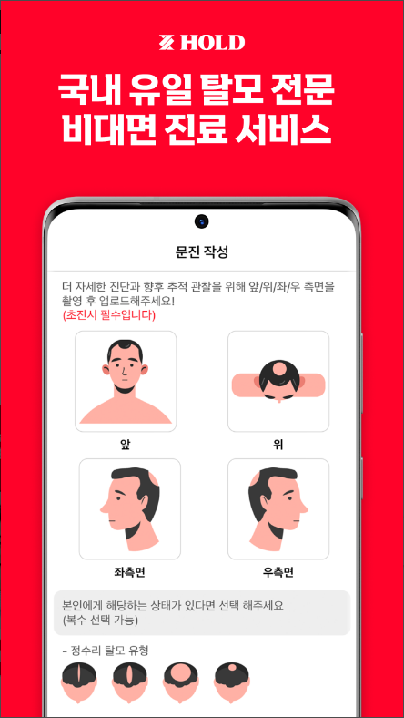 홀드, 탈모 비대면 진료, 약 배송 서비스