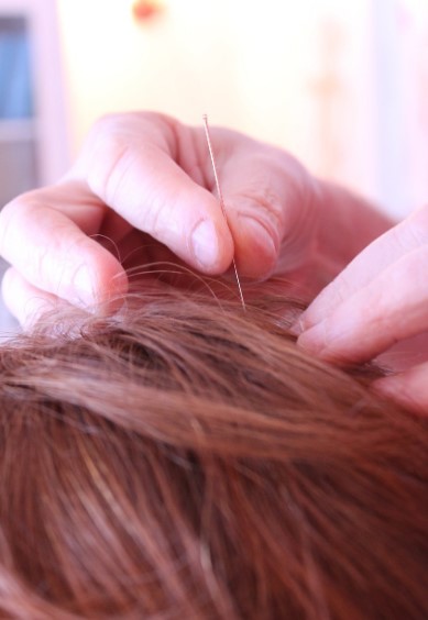 인천한방 탈모치료병원