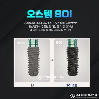 오스템 임플란트 수명 시술기간_8