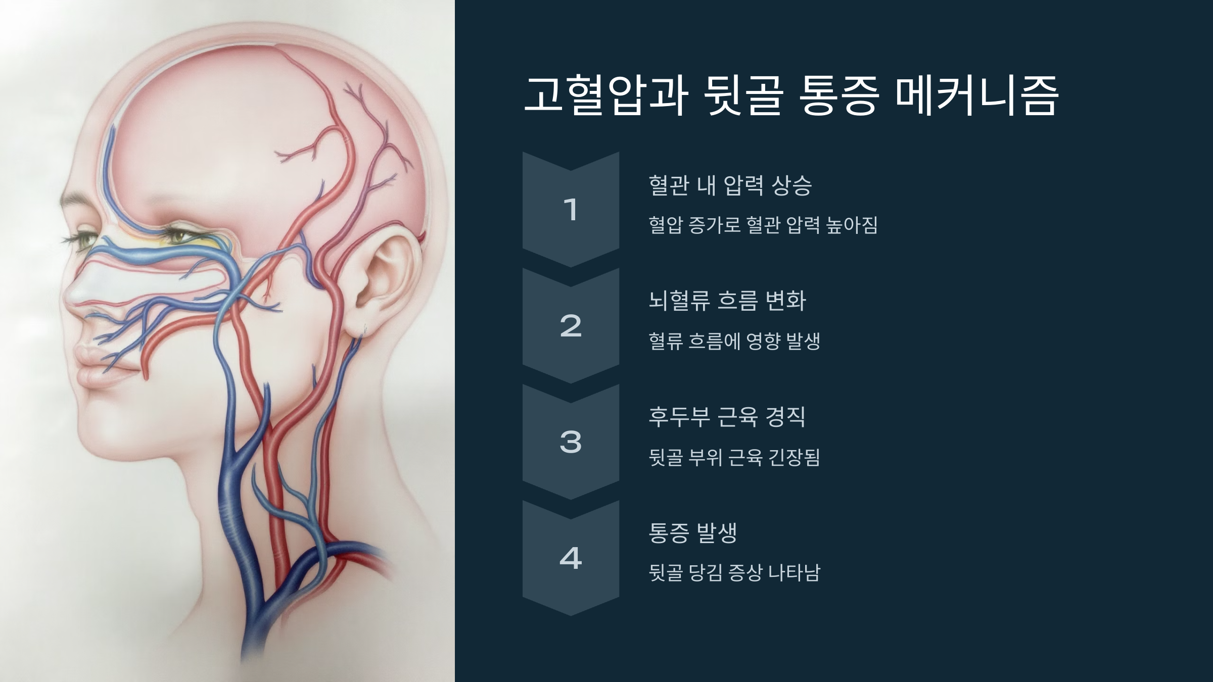 고혈압과 뒷골 통증 메커니즘