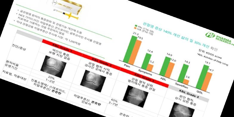 콘쥬란 주사 가격