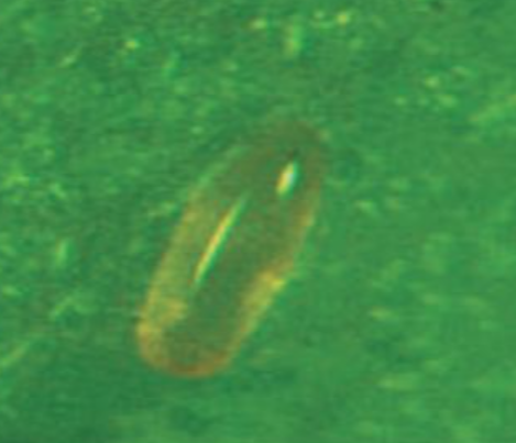 아까시잎혹파리