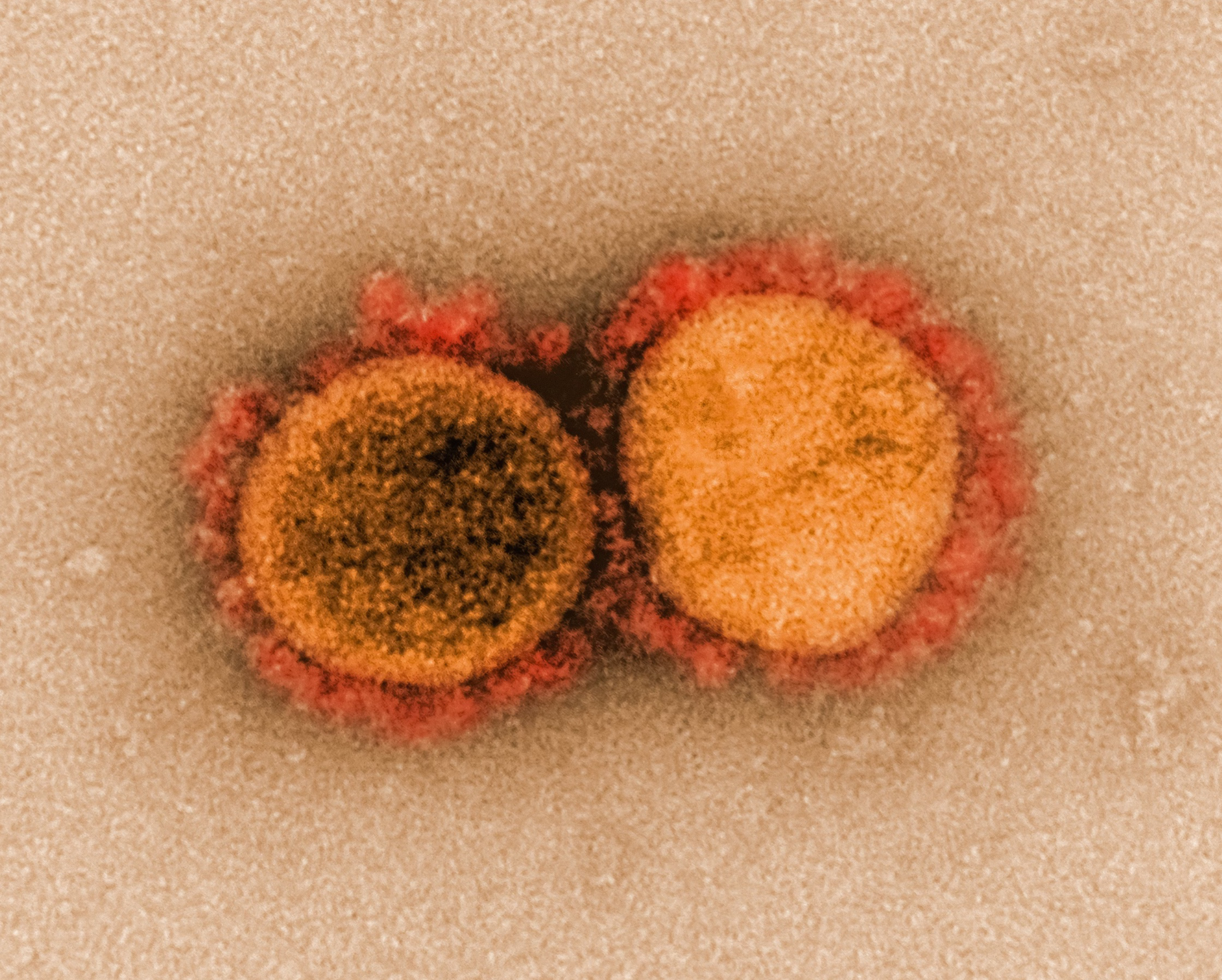 헬리코박터 전염