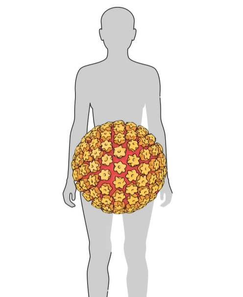 헤르페스 2형 증상