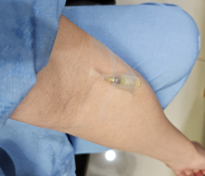 내시경 수면 약 주사 넣는 바늘 남성