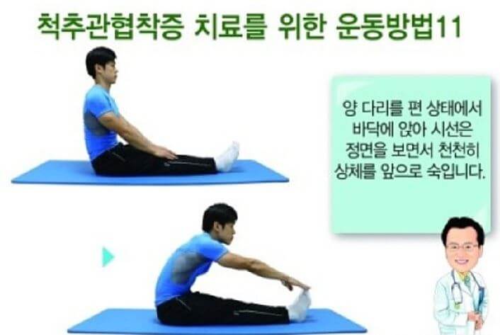 척추관협착증 치료방법 및 운동법