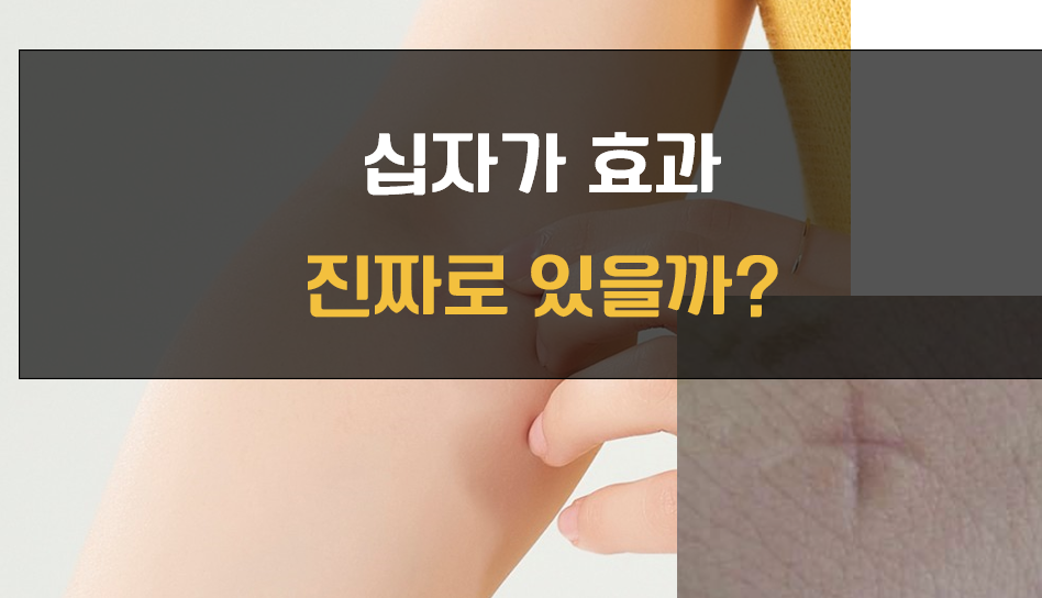 모기 십자가 대안