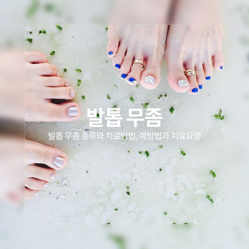 “발톱-무좀-종류와-치료방법”