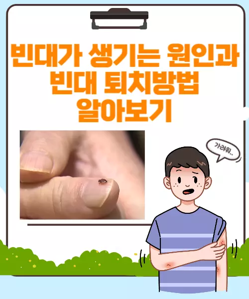 빈대퇴치