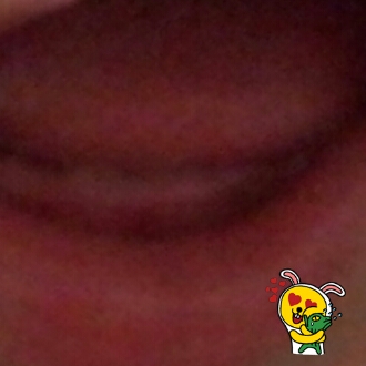 생후 6~7개월 아기 이빨