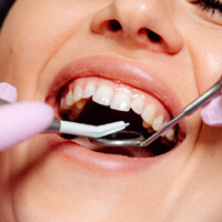 잇몸-치료하는-여성-사진