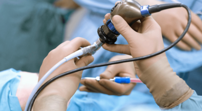 대장내시경이미지