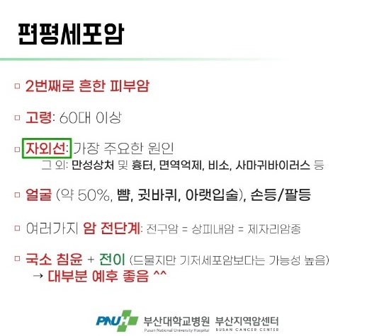 편평세포암
