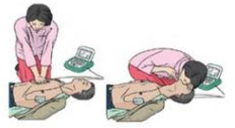 자동 제세동기, 자동 심장충격기(AED)의 사용법